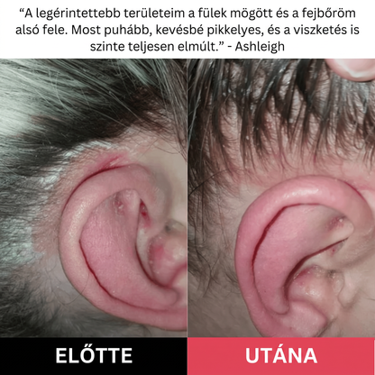 Hairsy – Fejbőrradír