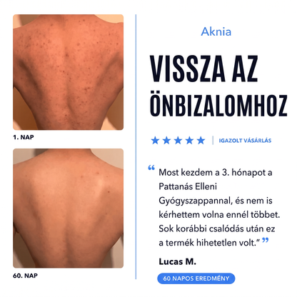 Aknia - Pattanás Elleni Gyógyszappan