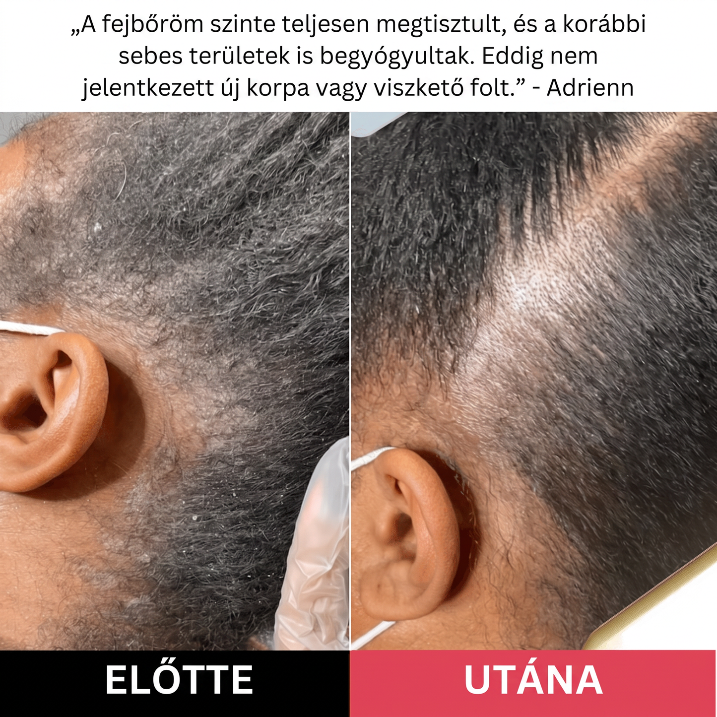 Hairsy – Fejbőrradír